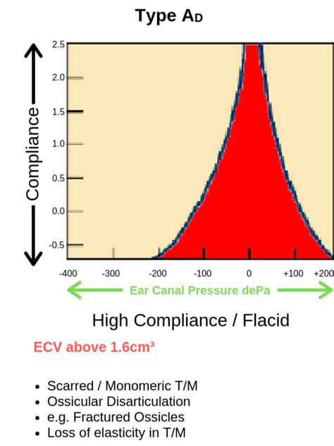 tympanometry type ad|tympanometry side effects.